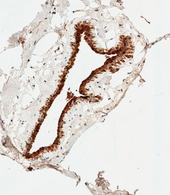 S100B Antibody in Immunohistochemistry (Paraffin) (IHC (P))