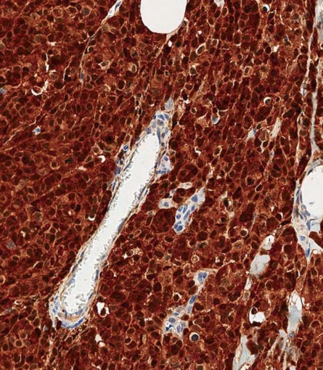 S100B Antibody in Immunohistochemistry (Paraffin) (IHC (P))