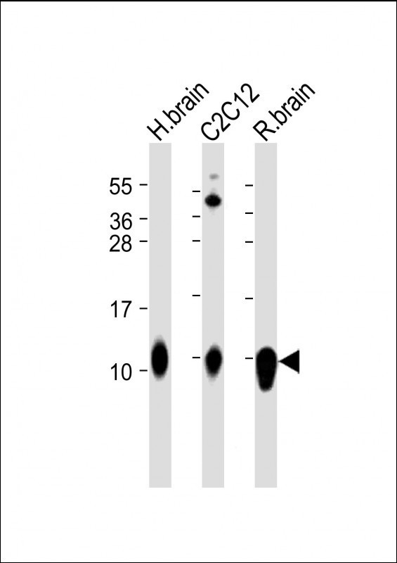 S100B Antibody in Western Blot (WB)