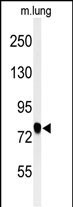 SEMA3C Antibody in Western Blot (WB)