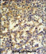 G6PD Antibody in Immunohistochemistry (Paraffin) (IHC (P))