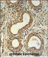 ROBO4 Antibody in Immunohistochemistry (Paraffin) (IHC (P))