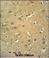 JHDM1D Antibody in Immunohistochemistry (Paraffin) (IHC (P))