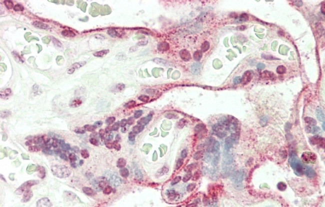 JHDM1D Antibody in Immunohistochemistry (Paraffin) (IHC (P))