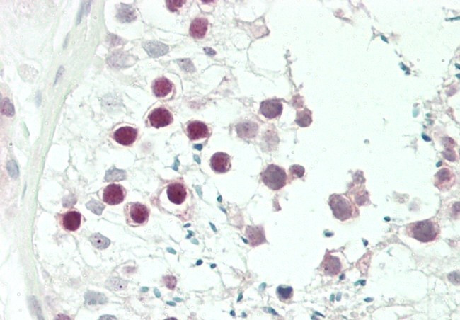 JHDM1D Antibody in Immunohistochemistry (Paraffin) (IHC (P))