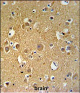 Tubulin beta-2C Antibody in Immunohistochemistry (Paraffin) (IHC (P))