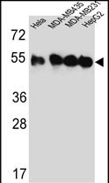 Tubulin beta-2C Antibody in Western Blot (WB)