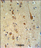 FAAH2 Antibody in Immunohistochemistry (Paraffin) (IHC (P))