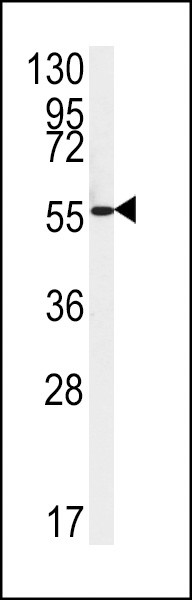 FAAH2 Antibody in Western Blot (WB)