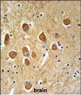 SAMD9L Antibody in Immunohistochemistry (Paraffin) (IHC (P))