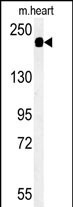 SAMD9L Antibody in Western Blot (WB)