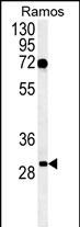 C19orf63 Antibody in Western Blot (WB)