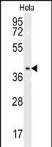 CMPK2 Antibody in Western Blot (WB)