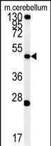 ENPP6 Antibody in Western Blot (WB)