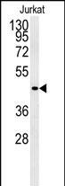 GPR41 Antibody in Western Blot (WB)