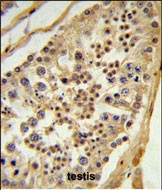 L1TD1 Antibody in Immunohistochemistry (Paraffin) (IHC (P))