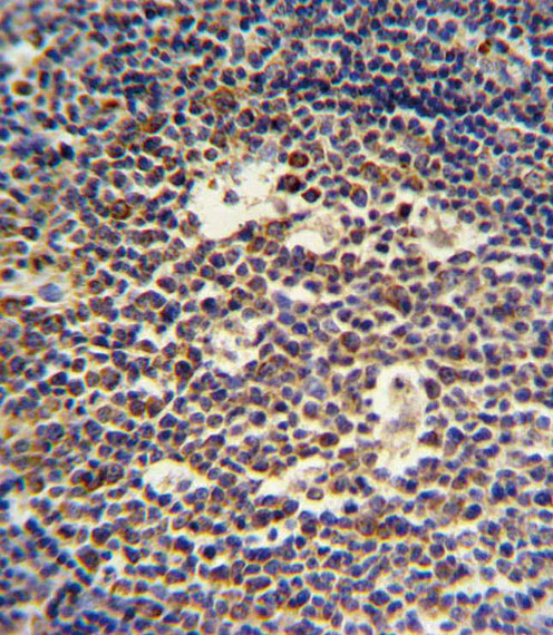 IL-4 Antibody in Immunohistochemistry (Paraffin) (IHC (P))