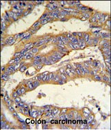 RSAD1 Antibody in Immunohistochemistry (Paraffin) (IHC (P))