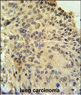 RSPO2 Antibody in Immunohistochemistry (Paraffin) (IHC (P))