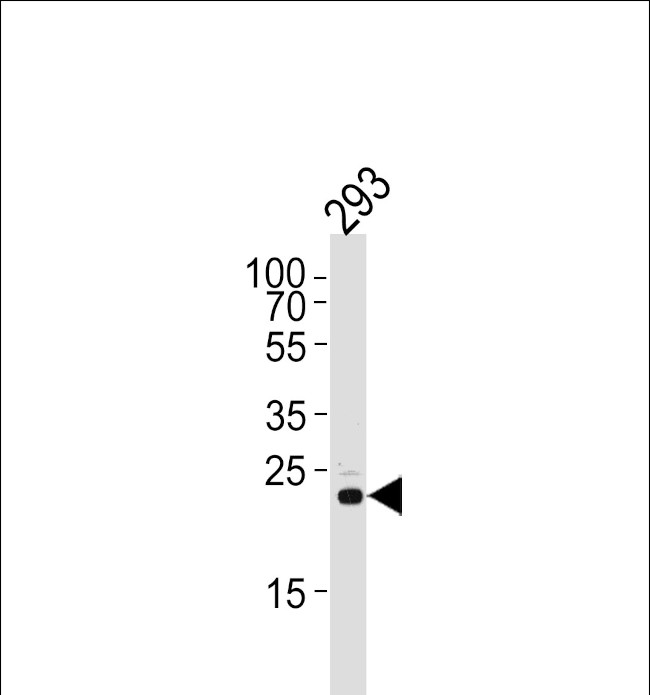 RSPO2 Antibody in Western Blot (WB)