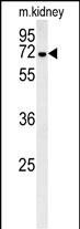 GNE Antibody in Western Blot (WB)