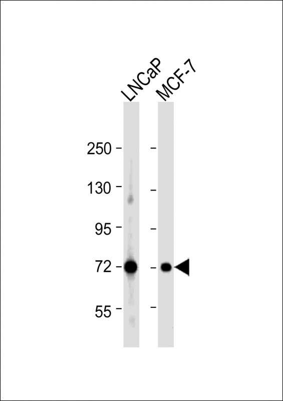 DLAT Antibody in Western Blot (WB)