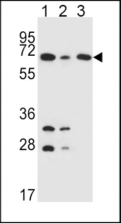 DLAT Antibody in Western Blot (WB)