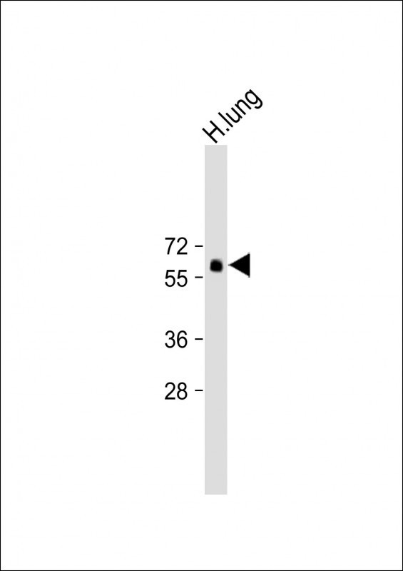 SMAD6 Antibody in Western Blot (WB)