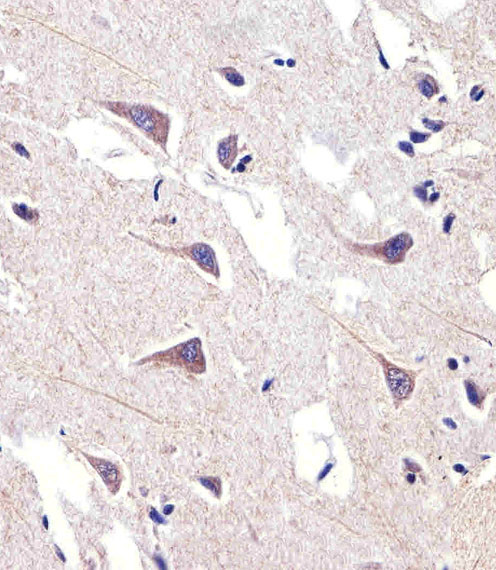 FADS2 Antibody in Immunohistochemistry (Paraffin) (IHC (P))