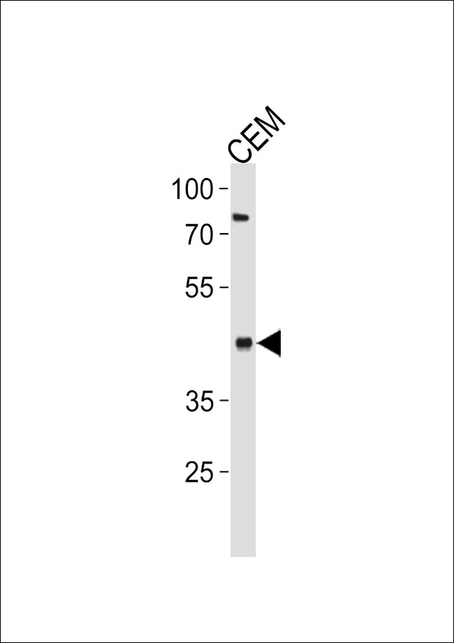 FADS2 Antibody in Western Blot (WB)