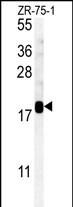 SDHAF1 Antibody in Western Blot (WB)