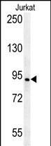 AXIN2 Antibody in Western Blot (WB)