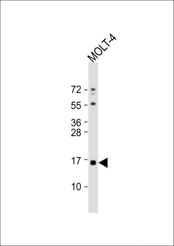 CRABP1 Antibody in Western Blot (WB)