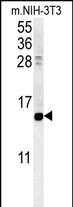 CRABP1 Antibody in Western Blot (WB)