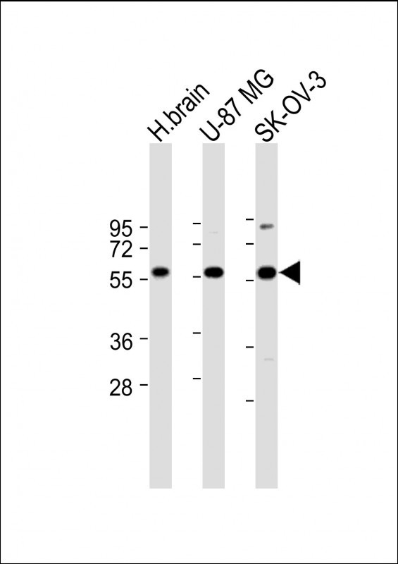 DYNC1LI2 Antibody in Western Blot (WB)