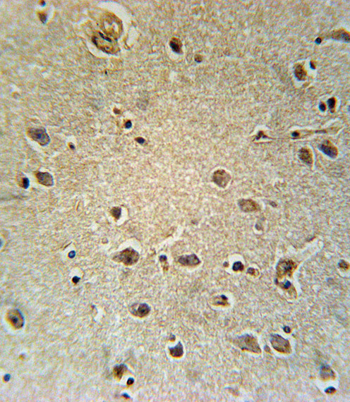 SLC25A1 Antibody in Immunohistochemistry (Paraffin) (IHC (P))