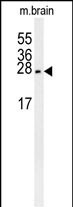 PMCH Antibody in Western Blot (WB)