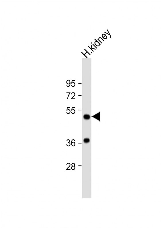 DOPA Decarboxylase Antibody in Western Blot (WB)