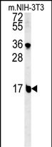 BLOC1S2 Antibody in Western Blot (WB)