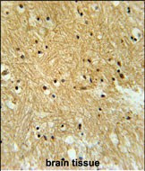 Importin 9 Antibody in Immunohistochemistry (Paraffin) (IHC (P))