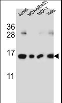 H2AFJ Antibody in Western Blot (WB)