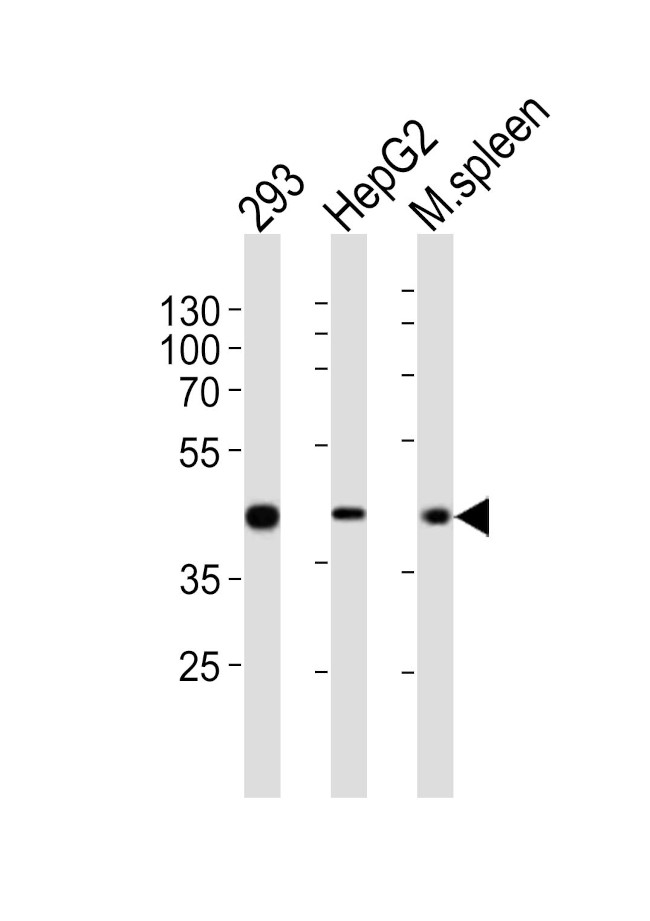 STEAP2 Antibody in Western Blot (WB)