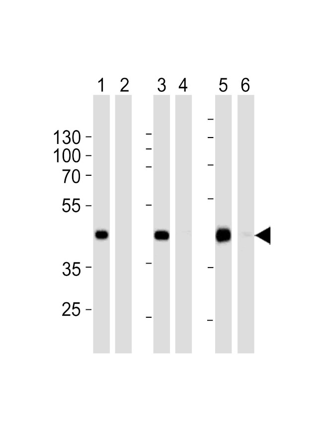 STEAP2 Antibody in Western Blot (WB)