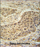 TAF1D Antibody in Immunohistochemistry (Paraffin) (IHC (P))