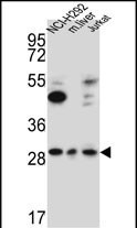 TAF1D Antibody in Western Blot (WB)