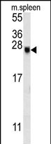 EID2 Antibody in Western Blot (WB)