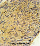 MURC Antibody in Immunohistochemistry (Paraffin) (IHC (P))