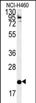 CRACC Antibody in Western Blot (WB)