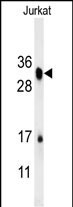 RSPO4 Antibody in Western Blot (WB)