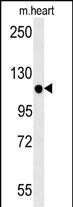 KIF24 Antibody in Western Blot (WB)